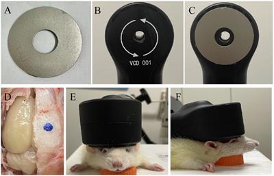Design and evaluation of a rodent-specific focal transcranial magnetic stimulation coil with the custom shielding application in rats